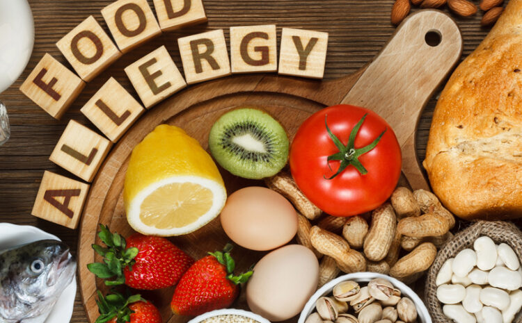  Τροφικές Αλλεργίες: Τα Συμπτώματα που Οπωσδήποτε δεν Πρέπει να Αγνοήσετε